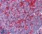 Goat Anti-GTRAP3-18 / JWA Antibody